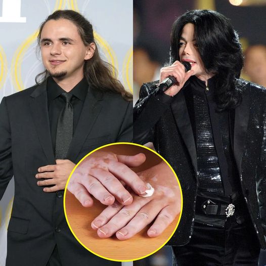 Prince Jackson Says Dad Michael Jackson Had ‘Insecurity’ Over His Vitiligo